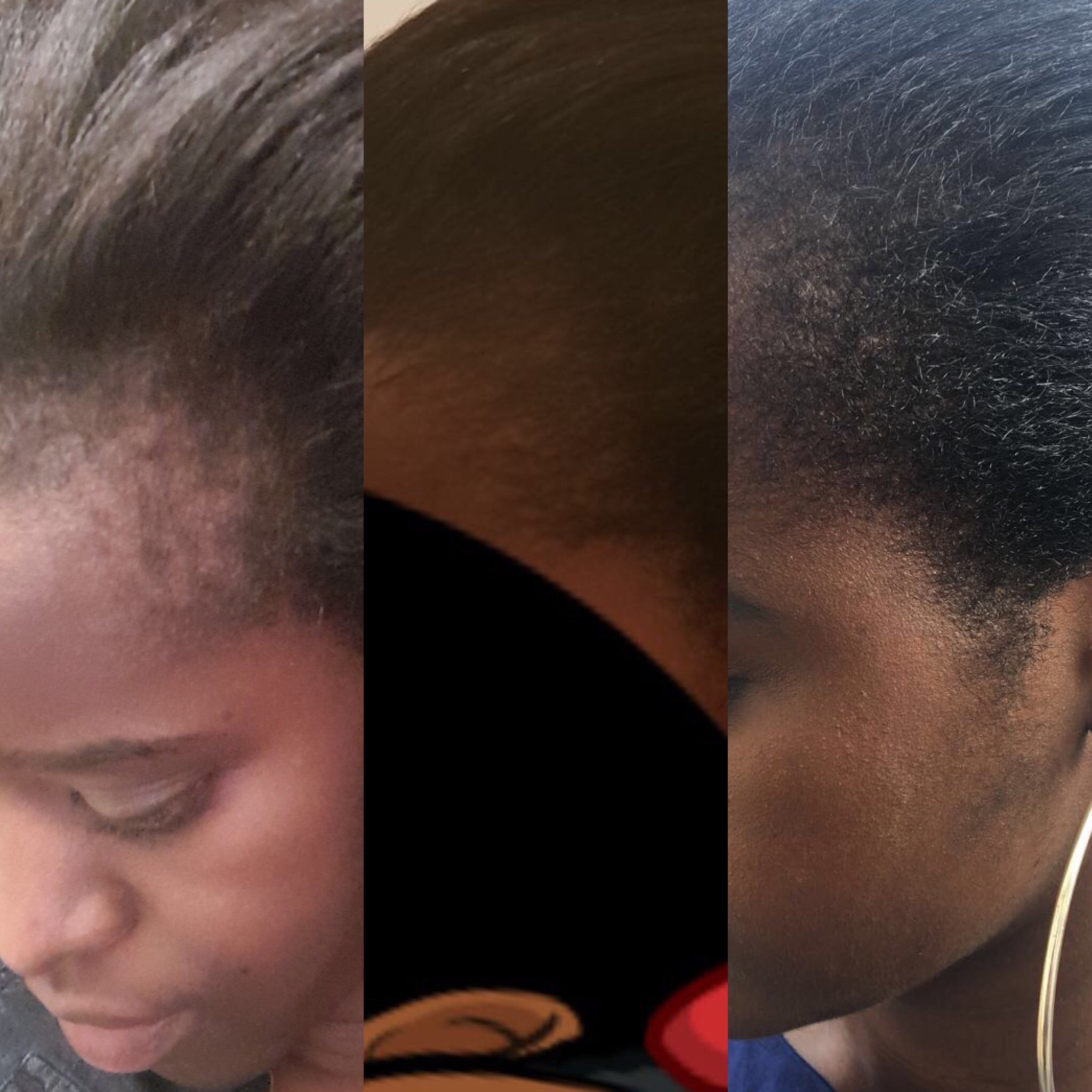 Hair Oil